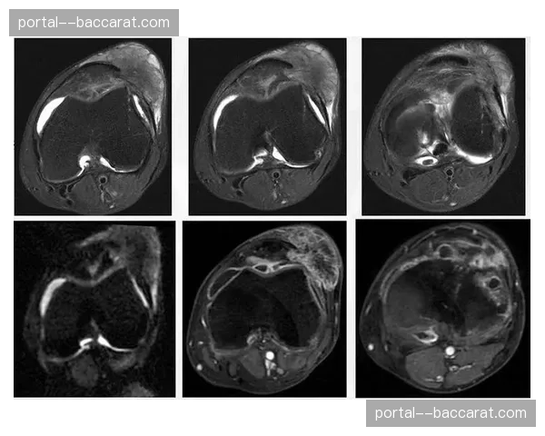 膝关节受伤出血预计休息两周 萨姆纳关键球处理能力暂时缺失 膝关节受伤出血预计休息两周 萨姆纳关键球处理能力暂时缺失
